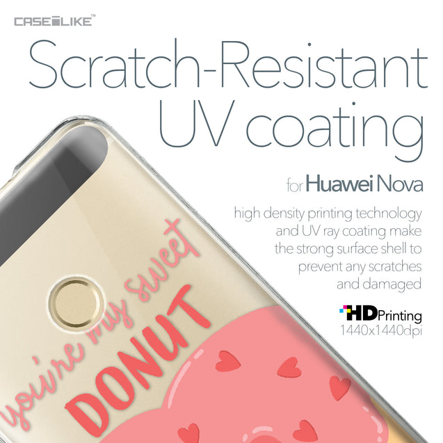 Huawei Nova case Dounuts 4823 with UV-Coating Scratch-Resistant Case | CASEiLIKE.com